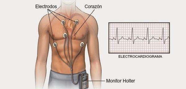 Holter ECG - Holter HTA